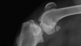 Radiografía latero-lateral